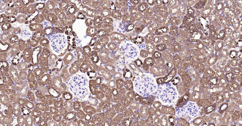 ALDH1L1 Recombinant Rabbit Monoclonal Antibody