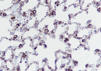 BCLG Recombinant Mouse Monoclonal Antibody