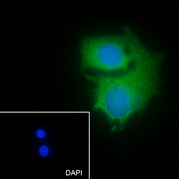 PSMA6 Recombinant Mouse Monoclonal Antibody