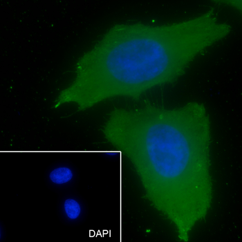 GRK2 Recombinant Rabbit Monoclonal Antibody