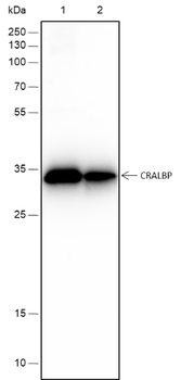 CRALBP Recombinant Rabbit Monoclonal Antibody