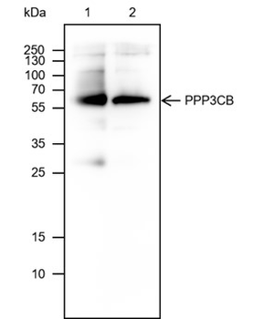 PPP3CB Mouse Monoclonal Antibody