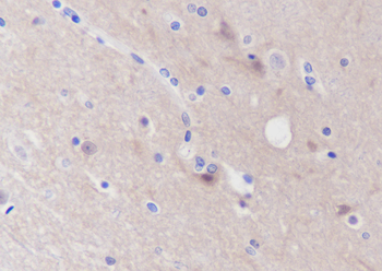 PPP3CB Mouse Monoclonal Antibody