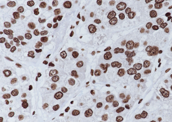 Acetyl-Histone H4 (Lys8) Mouse Monoclonal Antibody