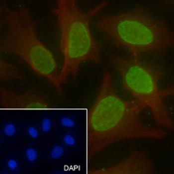 Di-Methyl-Histone H3 (Lys56) Rabbit Polyclonal Antibody