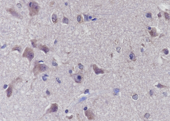 PAK3 Rabbit Polyclonal Antibody