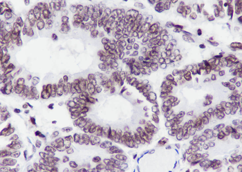 Acetyl-Histone H4 (Lys12) Mouse Monoclonal Antibody