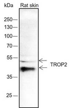TROP2 Recombinant Rabbit Monoclonal Antibody