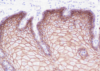 TROP2 Recombinant Rabbit Monoclonal Antibody