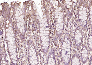 P4HB Recombinant Mouse Monoclonal Antibody