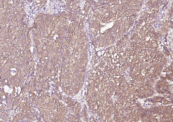 P4HB Recombinant Mouse Monoclonal Antibody