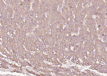 P4HB Recombinant Mouse Monoclonal Antibody