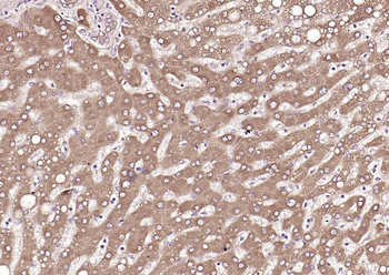 P4HB Recombinant Mouse Monoclonal Antibody