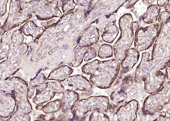 P4HB Recombinant Mouse Monoclonal Antibody