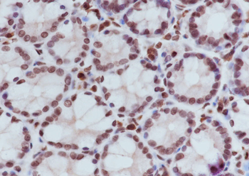 Di-Methyl-Histone H3 (Lys36) Rabbit Polyclonal Antibody