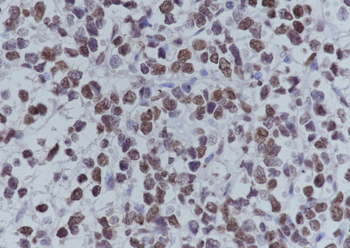 Acetyl-Histone H4 (Lys5/8/12/16) Recombinant Mouse Monoclonal Antibody