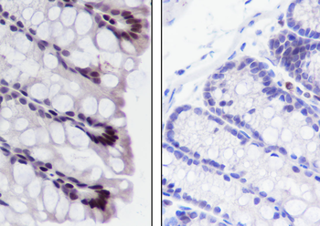 Propionyl-Histone H3 (Lys56) Recombinant Rabbit Monoclonal Antibody
