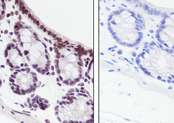 Propionyl-Histone H3 (Lys56) Recombinant Rabbit Monoclonal Antibody