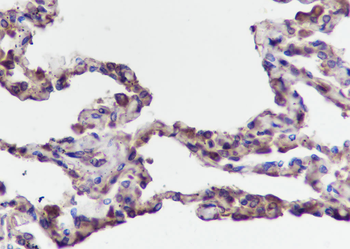 TMEM111 Recombinant Mouse Monoclonal Antibody
