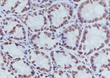 Tri-Methyl-Histone H4 (Lys20) Rabbit Polyclonal Antibody