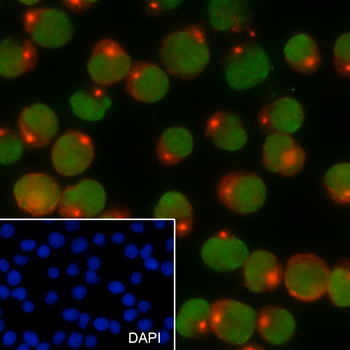 SETDB1 Recombinant Mouse Monoclonal Antibody