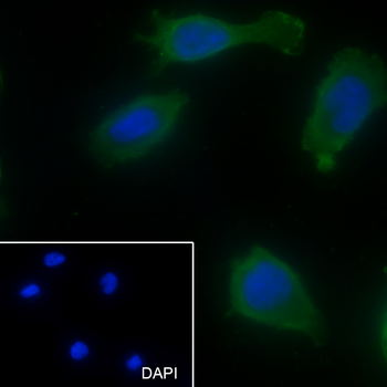 BTC Recombinant Mouse Monoclonal Antibody
