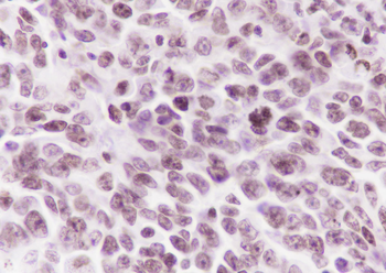 Mono-Methyl-Histone H3 (Lys36) Recombinant Rabbit Monoclonal Antibody