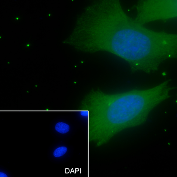 PLK-1 Recombinant Mouse Monoclonal Antibody