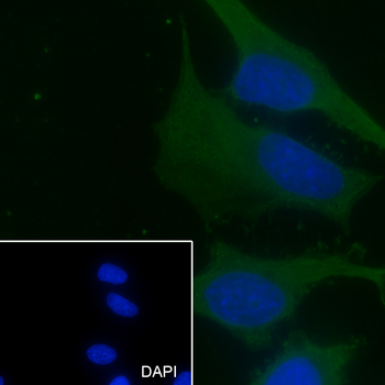 PCMT1 Recombinant Mouse Monoclonal Antibody