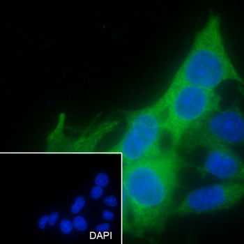 RRM2 Recombinant Mouse Monoclonal Antibody
