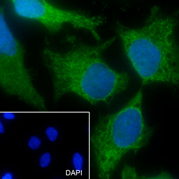 ATP5O Recombinant Mouse Monoclonal Antibody