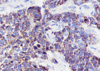 ECHS1 Recombinant Mouse Monoclonal Antibody