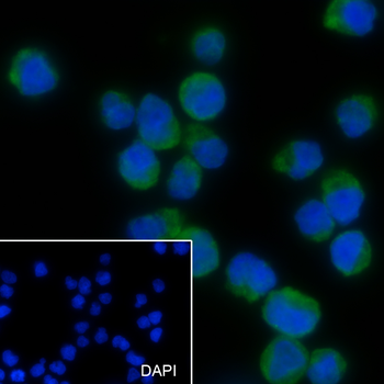 PSMB8 Recombinant Mouse Monoclonal Antibody