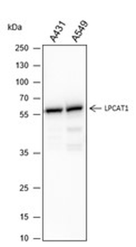 LPCAT1 Recombinant Mouse Monoclonal Antibody