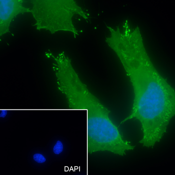 ERP29 Recombinant Mouse Monoclonal Antibody