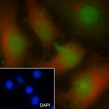 HRPT2 Recombinant Mouse Monoclonal Antibody