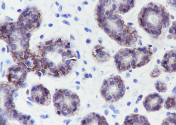 TROP2 Recombinant Rabbit Monoclonal Antibody