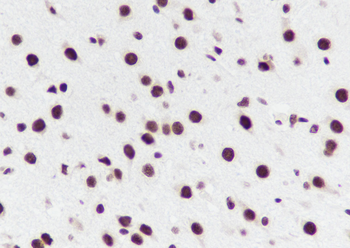 TDP-43 Recombinant Mouse Monoclonal Antibody