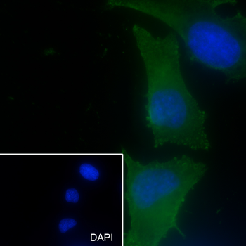 PTPN2 Recombinant Mouse Monoclonal Antibody