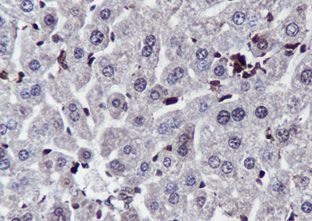 PTPN2 Recombinant Mouse Monoclonal Antibody
