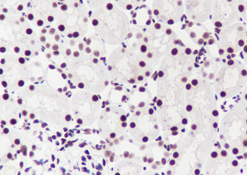 PABPN1 Recombinant Mouse Monoclonal Antibody