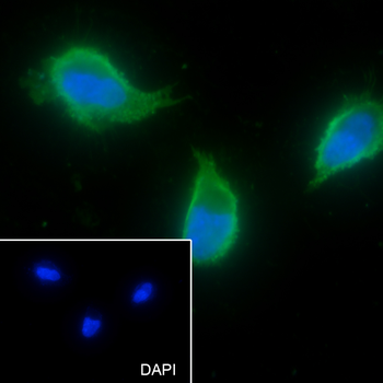 ACVR1B Recombinant Rabbit Monoclonal Antibody