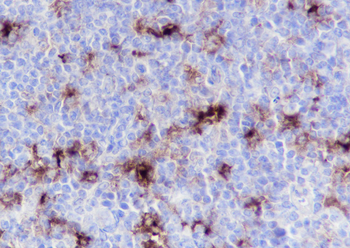 LY75 Recombinant Rabbit Monoclonal Antibody