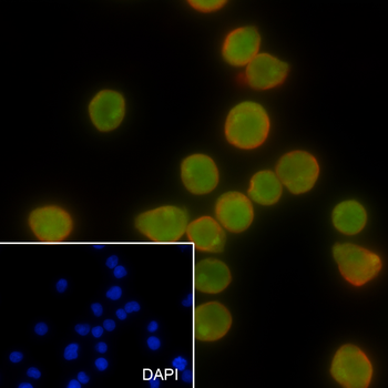SATB1 Recombinant Rabbit Monoclonal Antibody