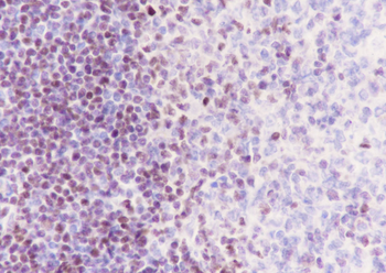 SATB1 Recombinant Rabbit Monoclonal Antibody