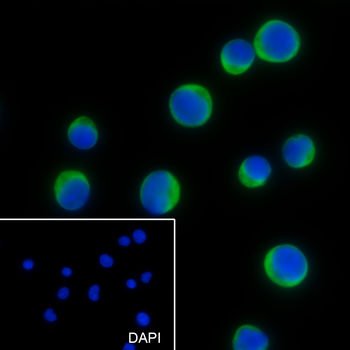 CD25 Recombinant Rabbit Monoclonal Antibody