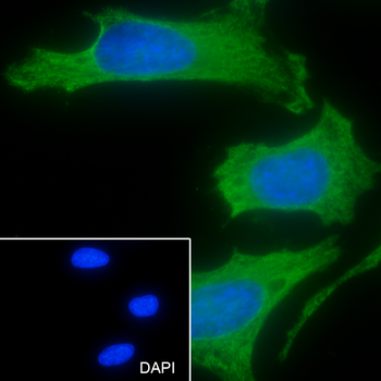 COPE Recombinant Mouse Monoclonal Antibody