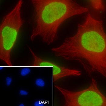 Mono-Methyl-Histone H3 (Lys23) Recombinant Rabbit Monoclonal Antibody