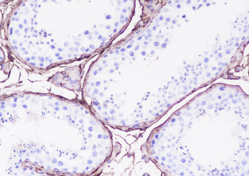 DPEP1 Recombinant Rabbit Monoclonal Antibody