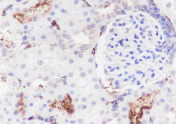DPEP1 Recombinant Rabbit Monoclonal Antibody